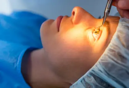 Customized LASIK